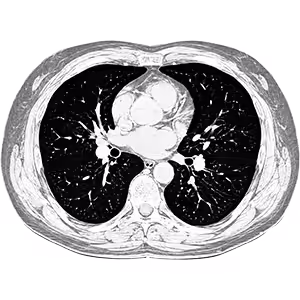 Cardiothoracic Reads
