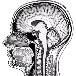 Neuroradiology Reads
