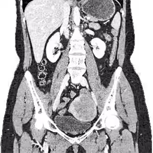 Body Imaging Reads