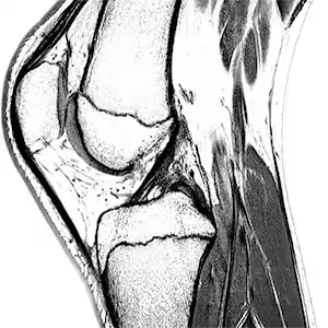 Musculoskeletal Reads