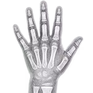 Pediatric Radiology Reads